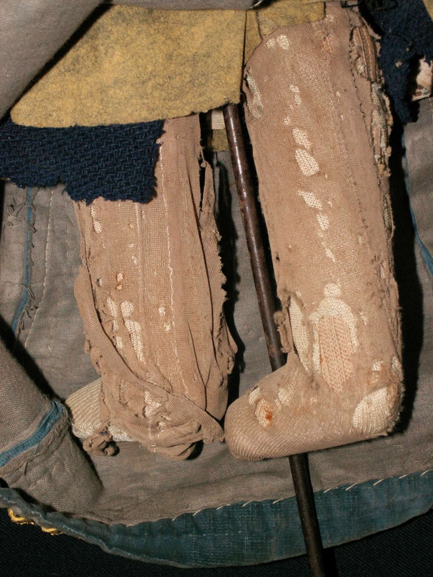 Calze prima del restauro retro